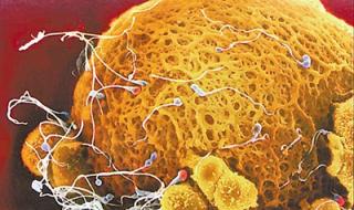 正常褐色分泌物图片